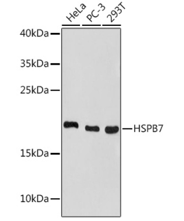 HSPB7 Rabbit Polyclonal Antibody