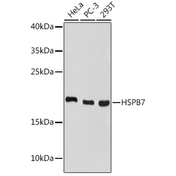 HSPB7 Rabbit Polyclonal Antibody