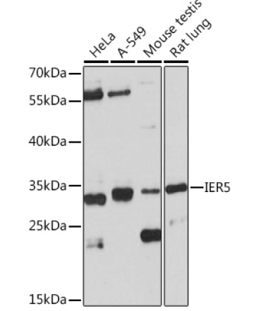 IER5 Rabbit Polyclonal Antibody