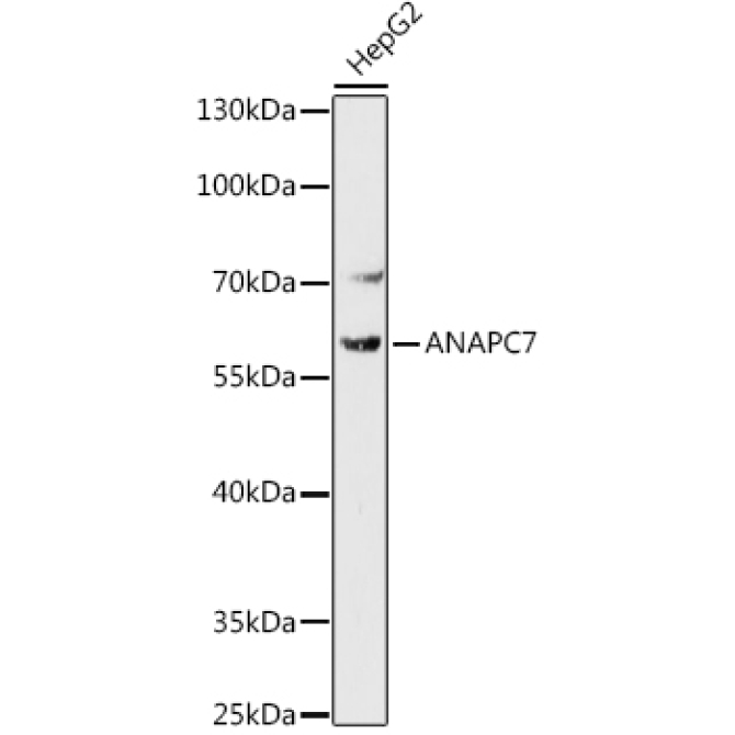 ANAPC7 Rabbit Polyclonal Antibody