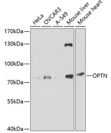 OPTN Rabbit Polyclonal Antibody