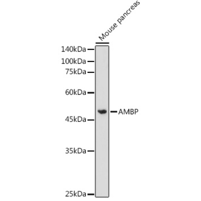 AMBP Rabbit Polyclonal Antibody