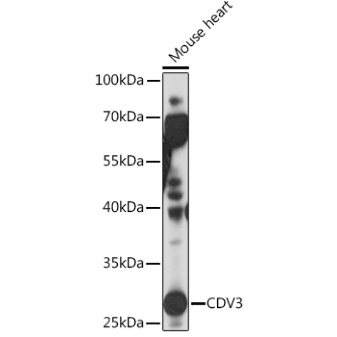 CDV3 Rabbit Polyclonal Antibody