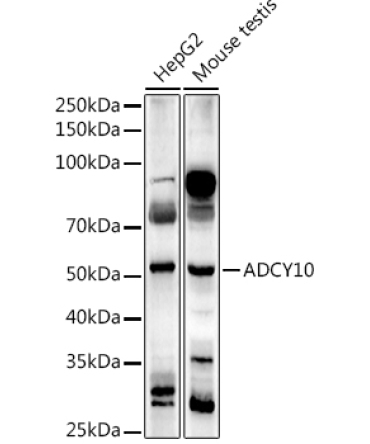 ADCY10 Rabbit Polyclonal Antibody