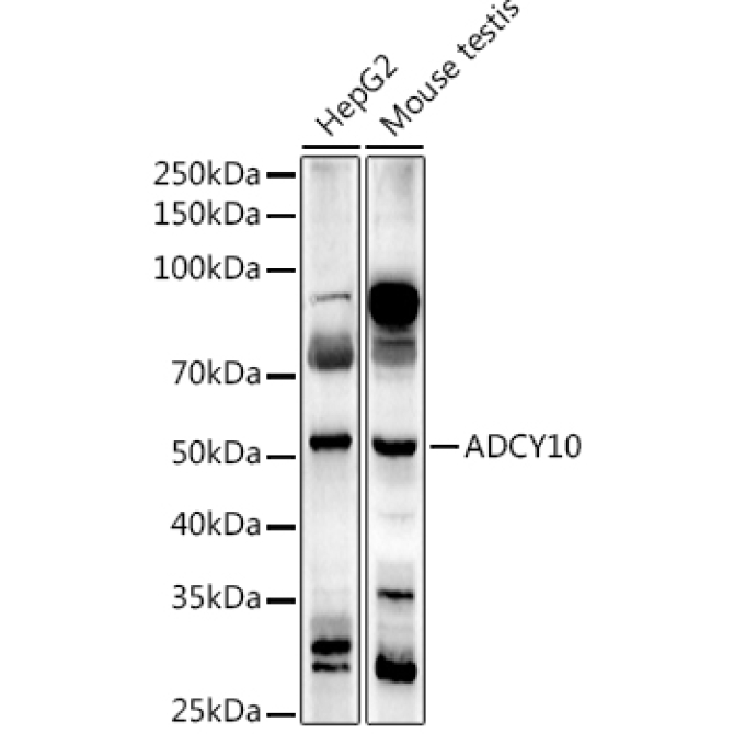 ADCY10 Rabbit Polyclonal Antibody