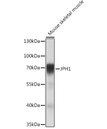 JPH1 Rabbit Polyclonal Antibody