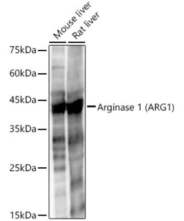 Arginase 1 (ARG1) Rabbit Polyclonal Antibody