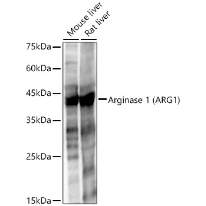Arginase 1 (ARG1) Rabbit Polyclonal Antibody