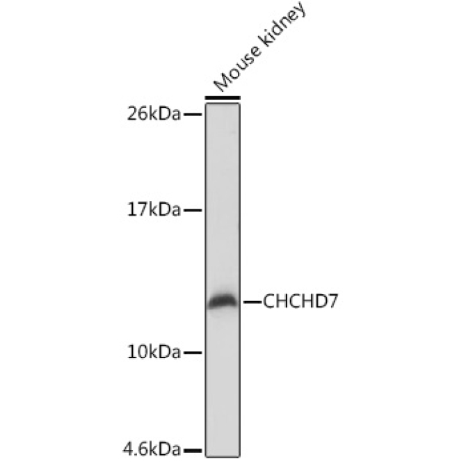 CHCHD7 Rabbit Polyclonal Antibody