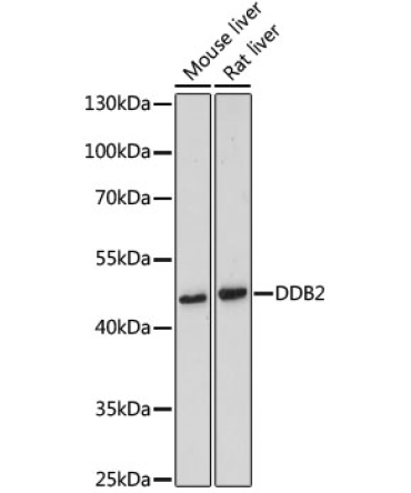 DDB2 Rabbit Polyclonal Antibody