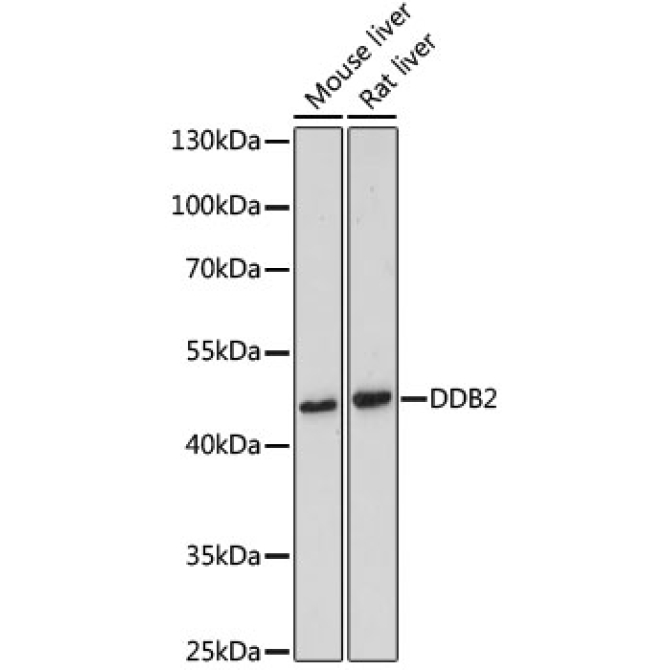 DDB2 Rabbit Polyclonal Antibody