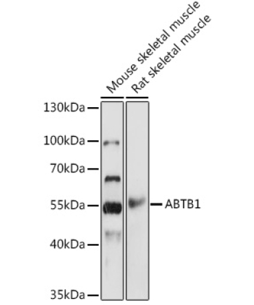 ABTB1 Rabbit Polyclonal Antibody