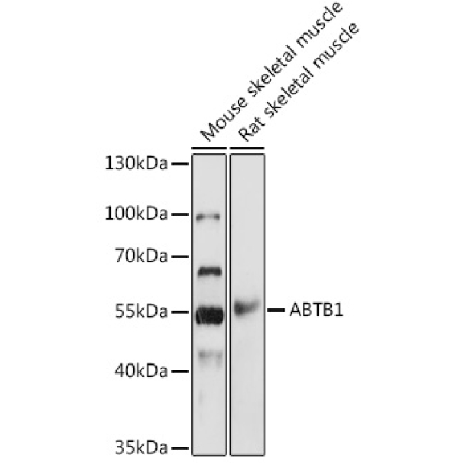 ABTB1 Rabbit Polyclonal Antibody