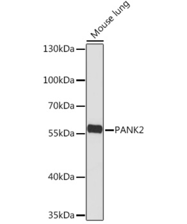 PANK2 Rabbit Polyclonal Antibody
