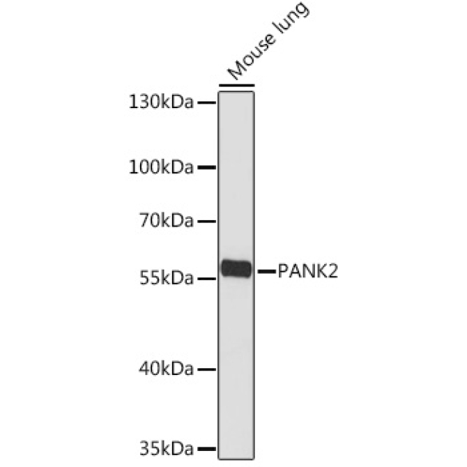 PANK2 Rabbit Polyclonal Antibody