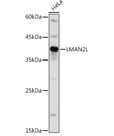 LMAN2L Rabbit Polyclonal Antibody