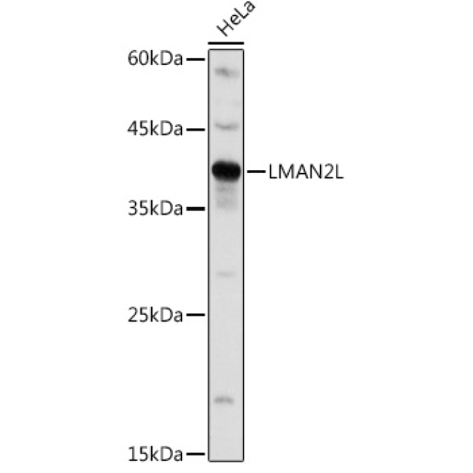 LMAN2L Rabbit Polyclonal Antibody