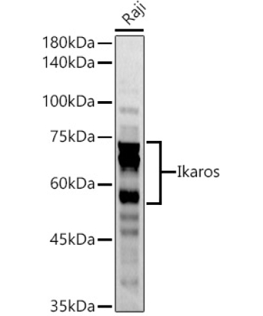 Ikaros Rabbit Polyclonal Antibody