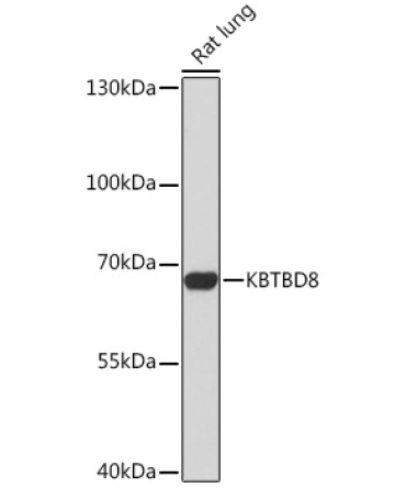 KBTBD8 Rabbit Polyclonal Antibody