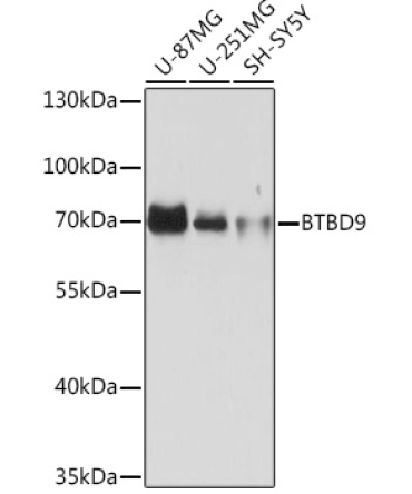 BTBD9 Rabbit Polyclonal Antibody
