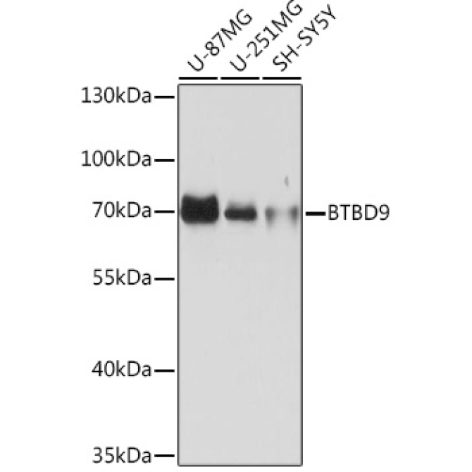 BTBD9 Rabbit Polyclonal Antibody