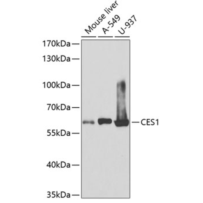 CES1 Rabbit Polyclonal Antibody