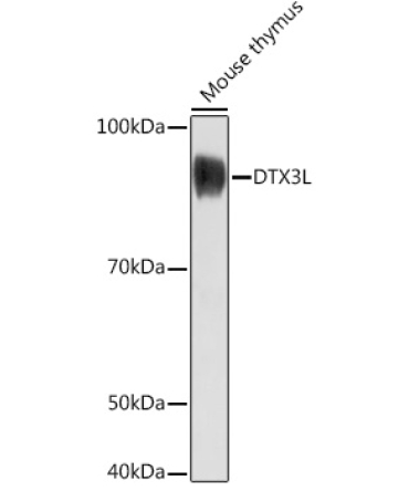 DTX3L Rabbit Polyclonal Antibody