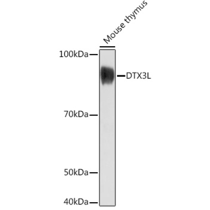 DTX3L Rabbit Polyclonal Antibody