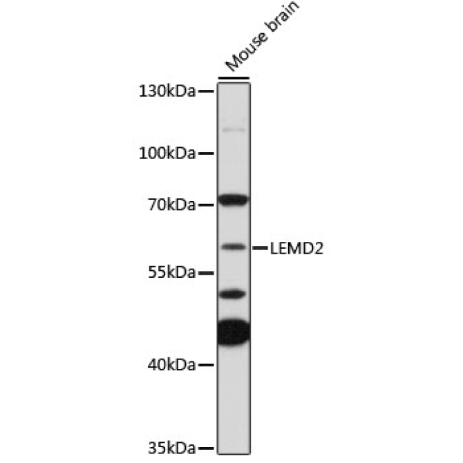 LEMD2 Rabbit Polyclonal Antibody