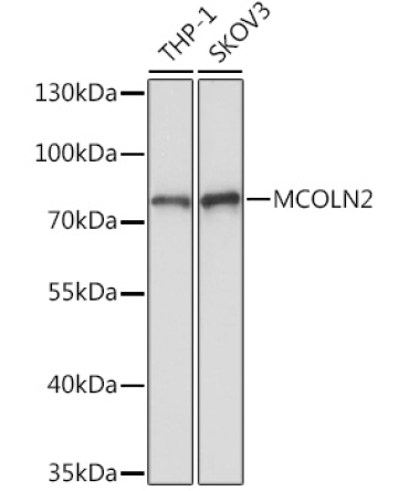 MCOLN2 Rabbit Polyclonal Antibody