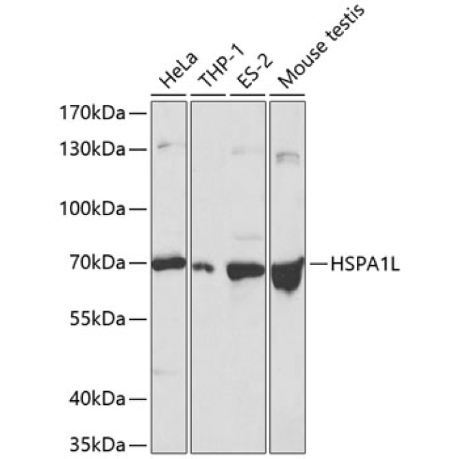 HSPA1L Rabbit Polyclonal Antibody