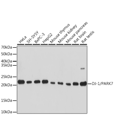 DJ-1/PARK7 Rabbit Polyclonal Antibody