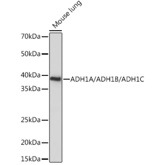 ADH1A/ADH1B/ADH1C Rabbit Polyclonal Antibody