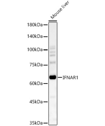 IFNAR1 Rabbit Polyclonal Antibody