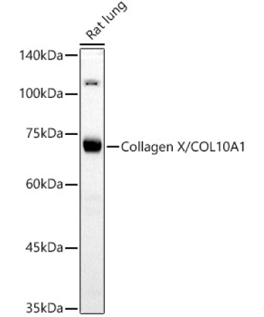 Collagen X/COL10A1 Rabbit Polyclonal Antibody
