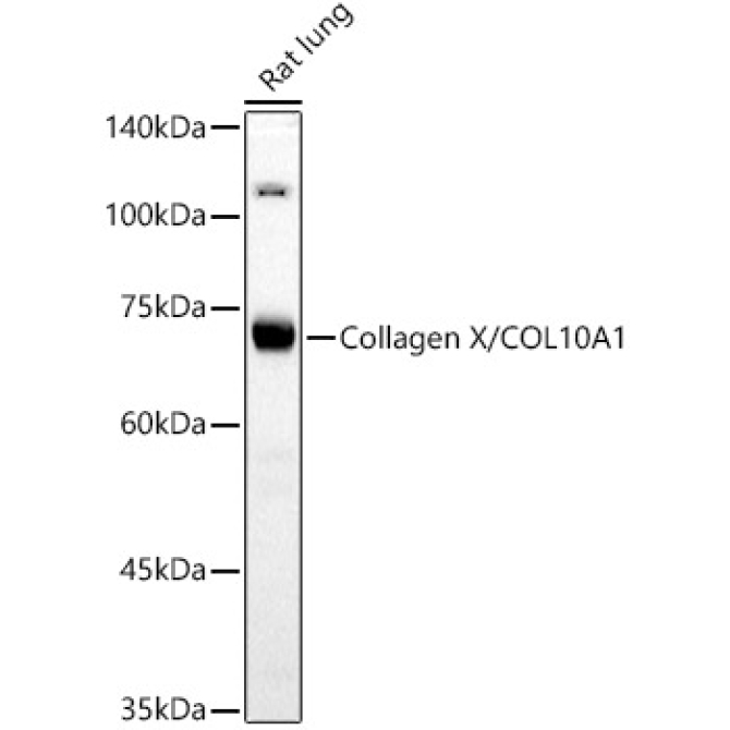 Collagen X/COL10A1 Rabbit Polyclonal Antibody