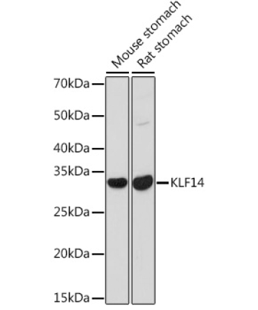 KLF14 Rabbit Polyclonal Antibody