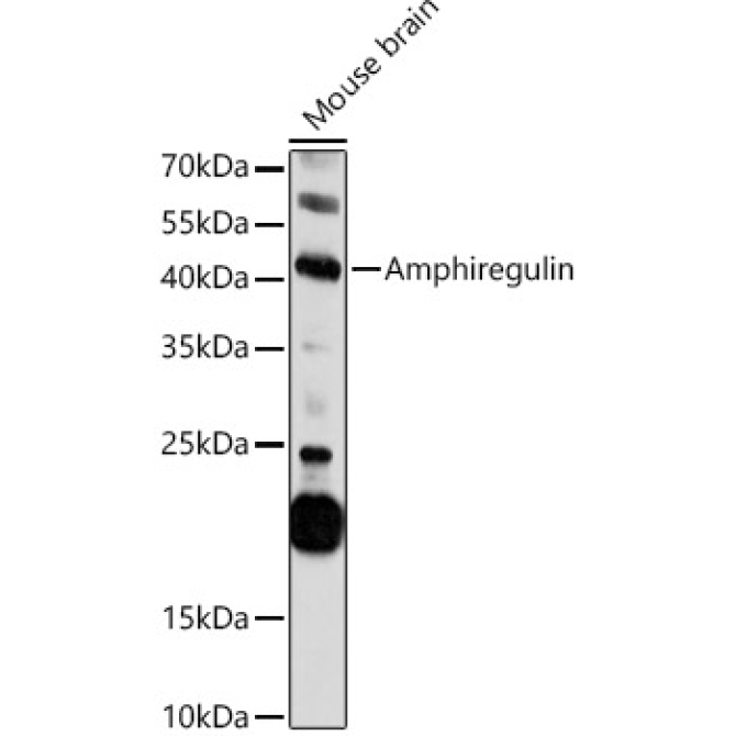 Amphiregulin Rabbit Polyclonal Antibody