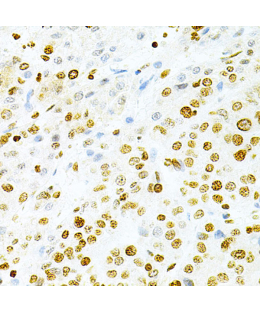 DKC1 Rabbit Polyclonal Antibody