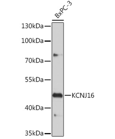 KCNJ16 Rabbit Polyclonal Antibody