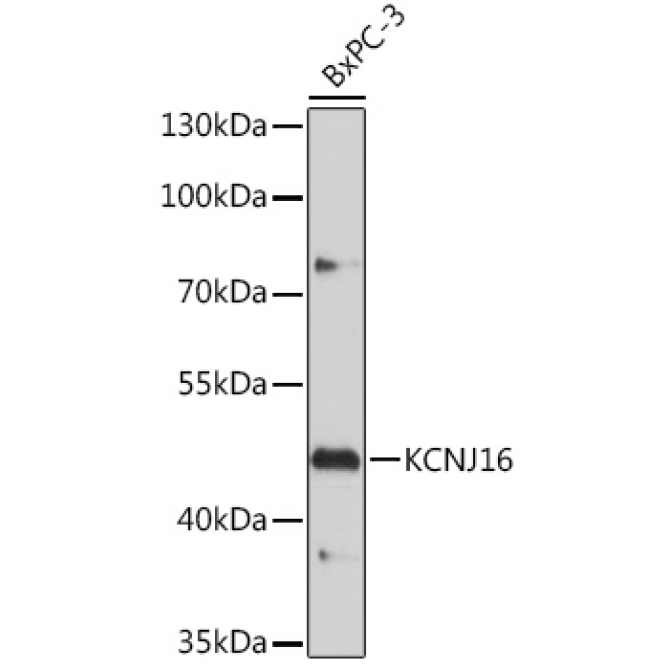 KCNJ16 Rabbit Polyclonal Antibody