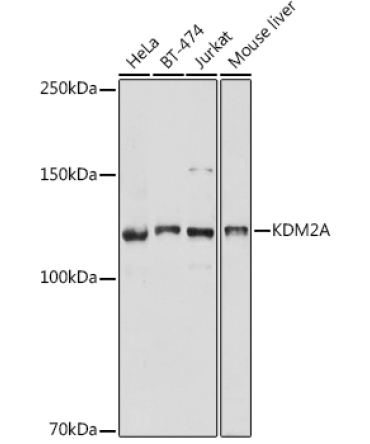 KDM2A Rabbit Polyclonal Antibody