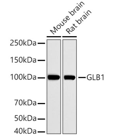 GLB1 Rabbit Polyclonal Antibody