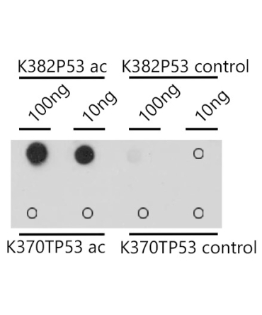 Acetyl-p53-K382 Rabbit Polyclonal Antibody