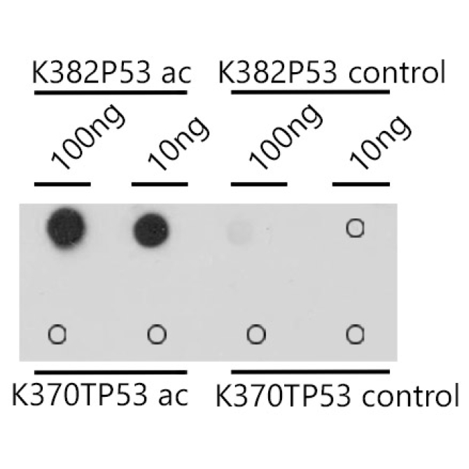 Acetyl-p53-K382 Rabbit Polyclonal Antibody