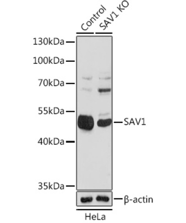 SAV1 Rabbit Polyclonal Antibody [KO Validated]