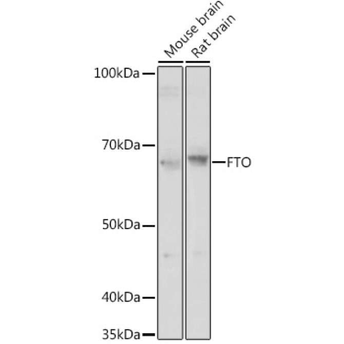FTO Rabbit Polyclonal Antibody