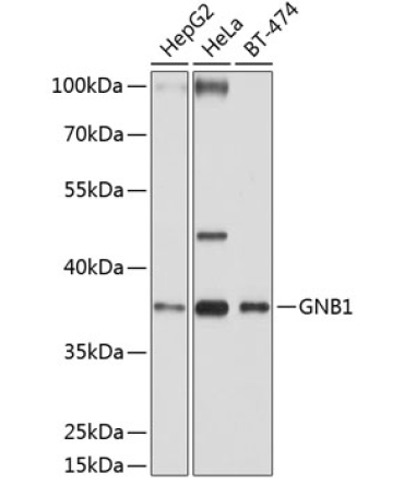 GNB1 Rabbit Polyclonal Antibody