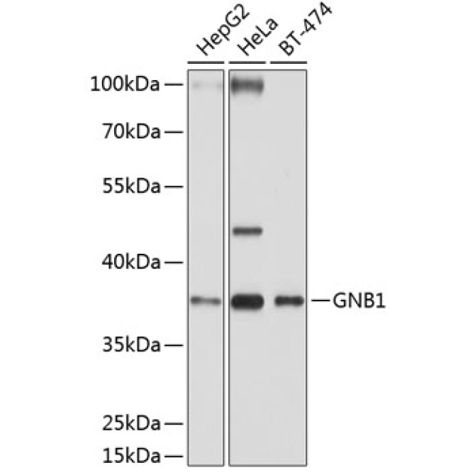 GNB1 Rabbit Polyclonal Antibody