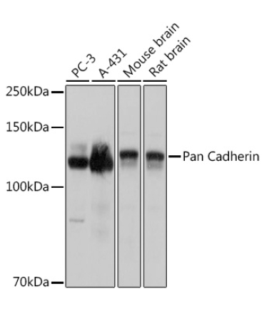 Pan Cadherin Rabbit Polyclonal Antibody